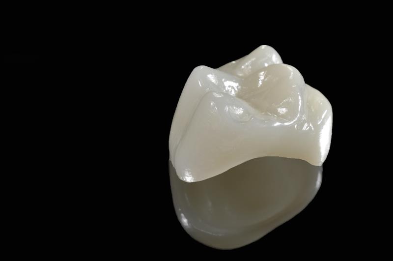 Same-day dental crowns in South Edmonton